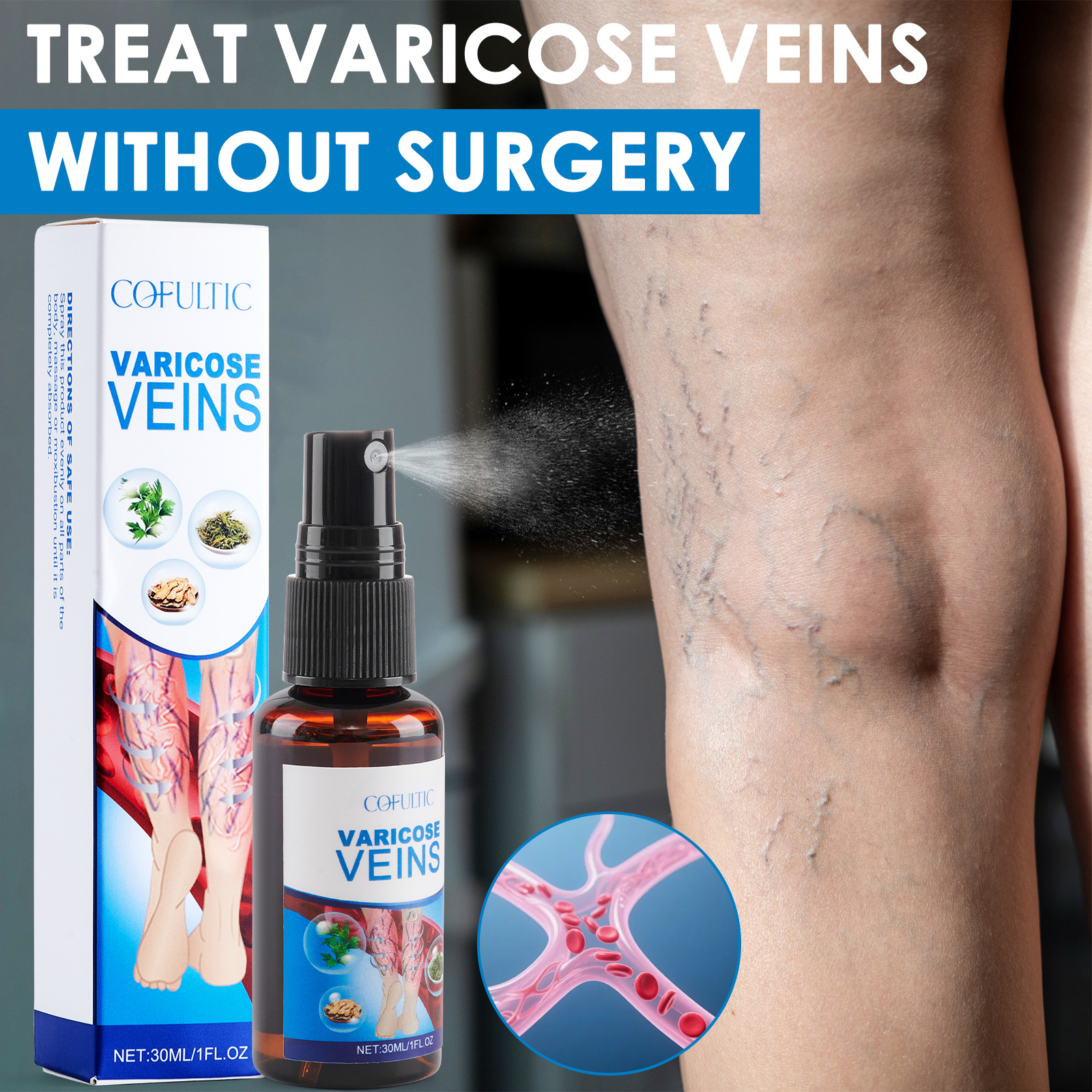 215966ac-8ab5-4f7d-b5f1-970b75def31a.jpg 30ml Varicose Vein Spray Multi-Purpose Knee And Leg Care Spray Promote Blood Circulation - Image 1